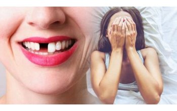 Nằm Mơ Thấy Rụng Răng Là Điềm Tốt Hay Xấu?