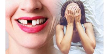 Nằm Mơ Thấy Rụng Răng Là Điềm Tốt Hay Xấu?